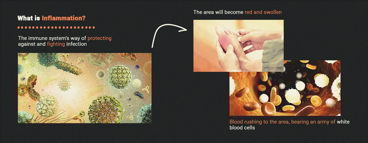 What Is Inflammation? What Is Inflammation?