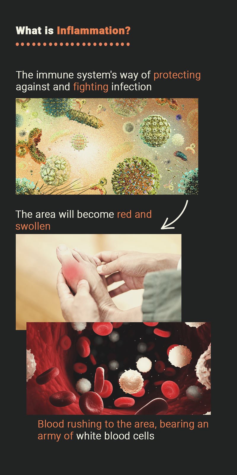 What Is Inflammation? What Is Inflammation?
