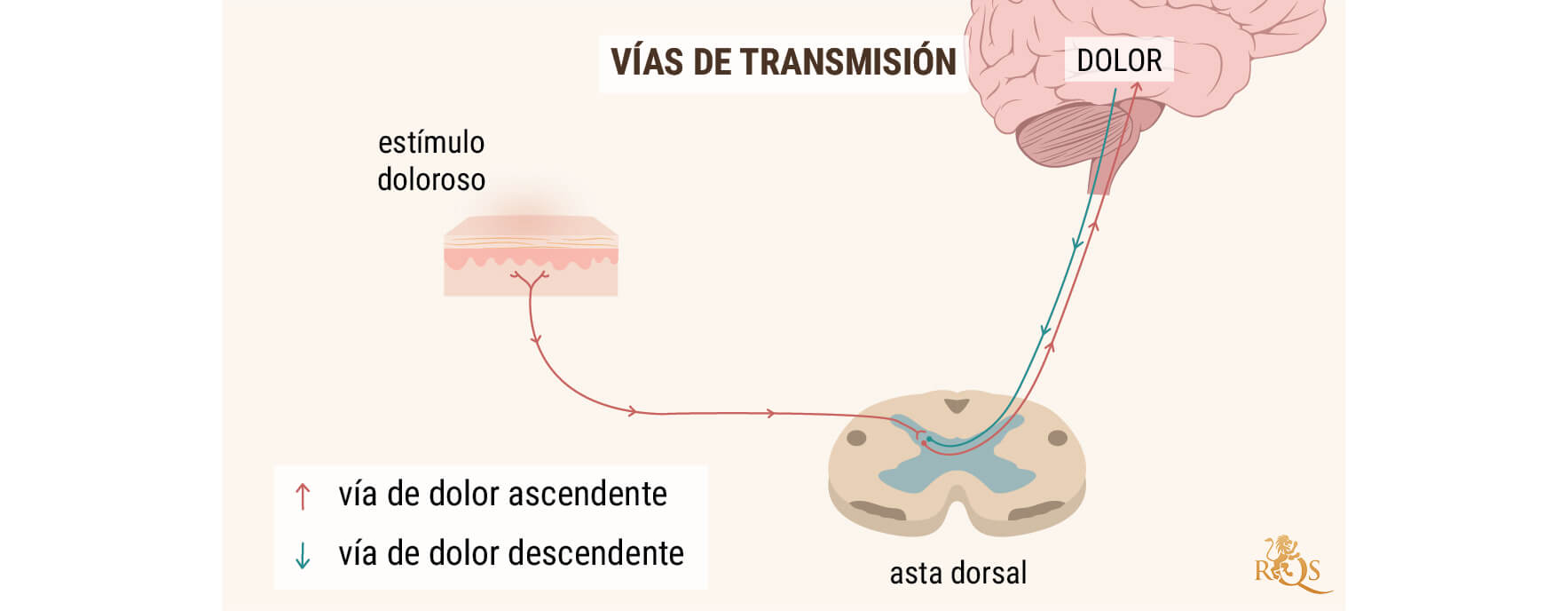 ACEITE DE CBD PARA EL DOLOR