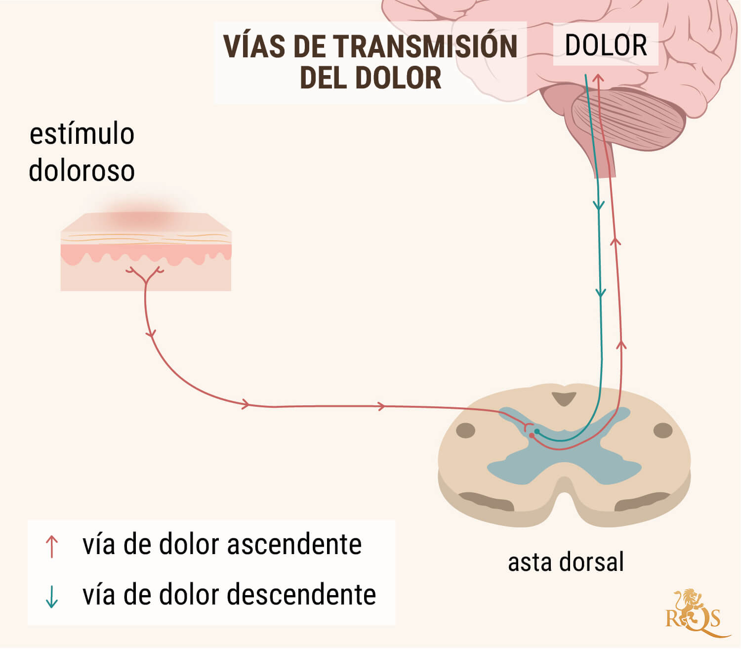 ACEITE DE CBD PARA EL DOLOR