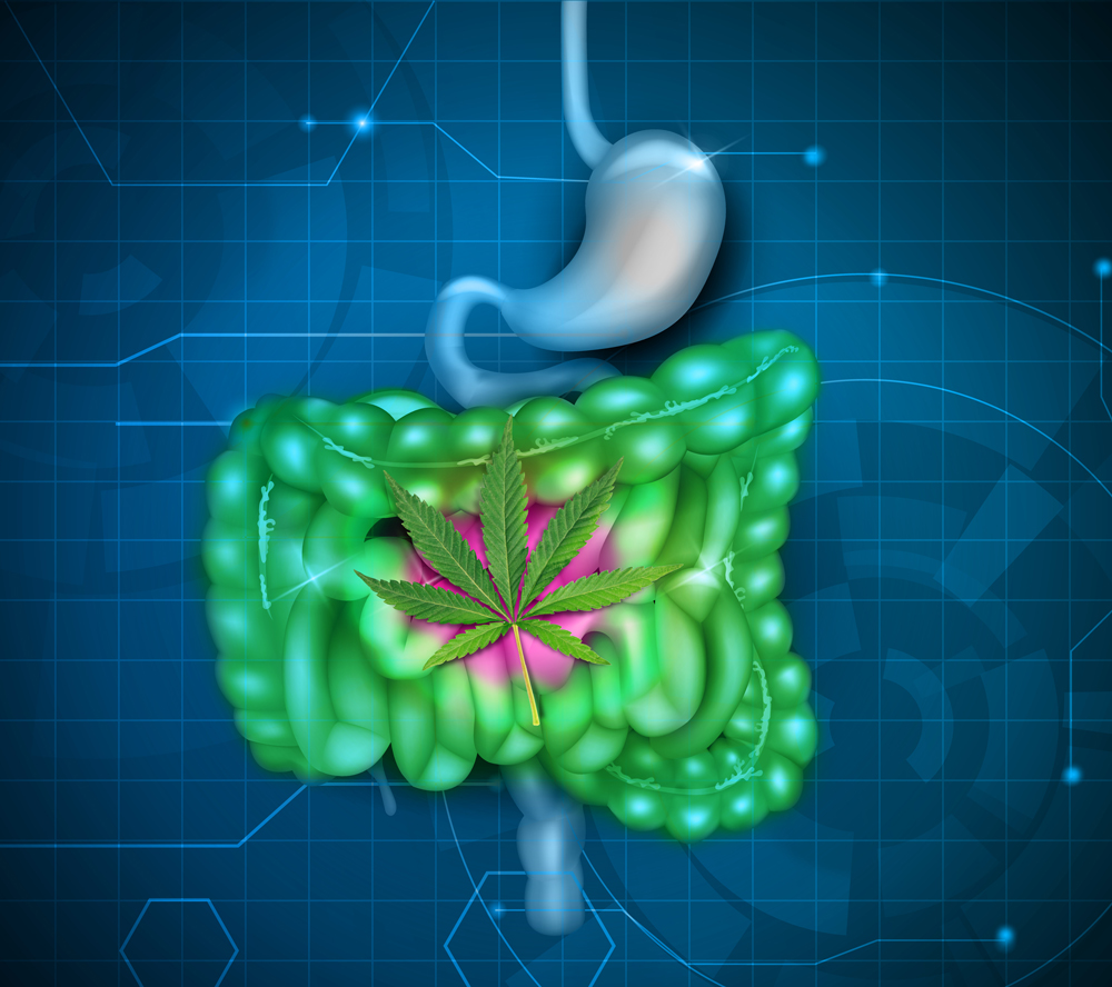 irritable bowel collistis
