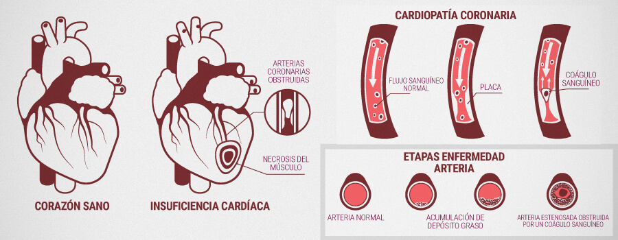 Problemas Cardíacos Y Cómo Puede Ayudar Cbd Problemas Cardíacos Y Cómo Puede Ayudar Cbd