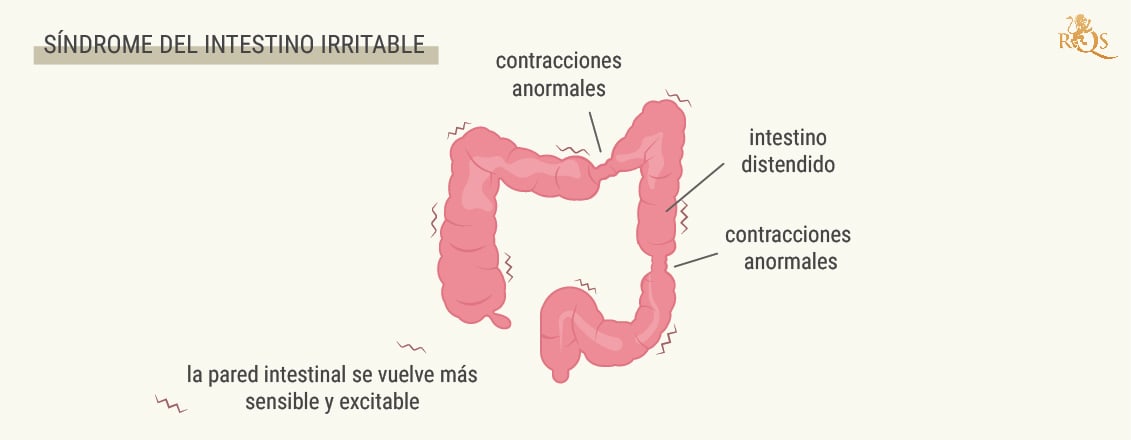 ¿Qué es el SII?