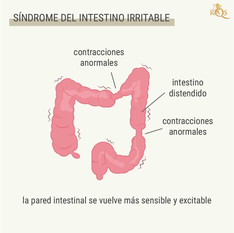 ¿Qué es el SII?