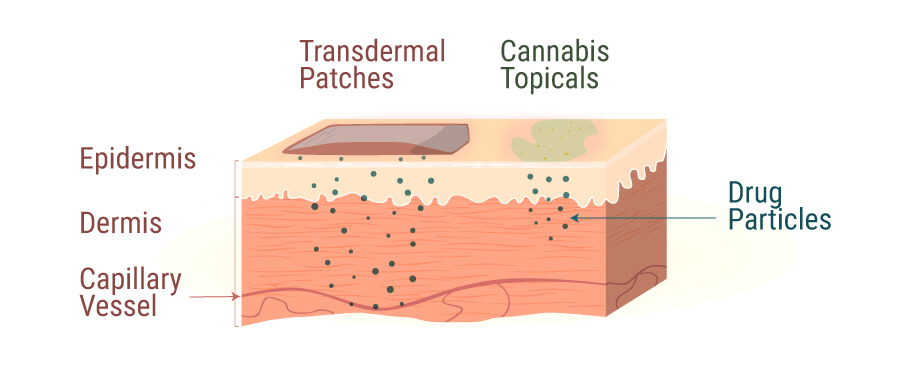 Los Productos Tópicos Se Infusionan Con Una Variedad De Cannabinoides