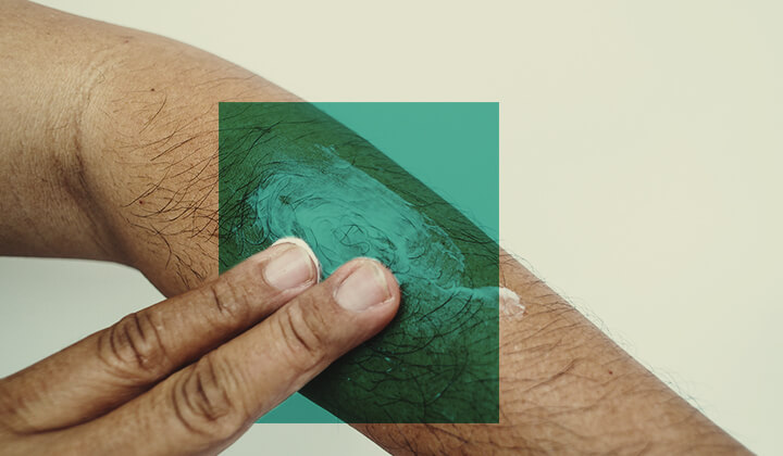 ¿Cómo usar el CBD para cuidar la piel? ¿Cómo usar el CBD para cuidar la piel?