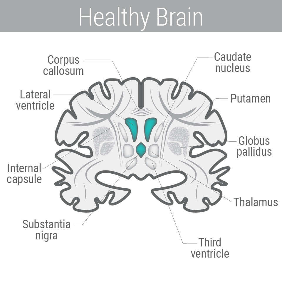 Parkinson's Disease Parkinson's Disease