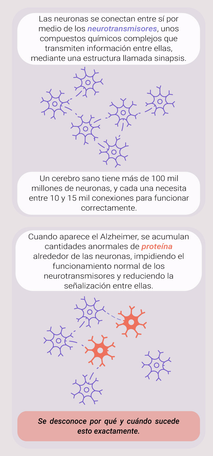 What Causes Alzheimer What Causes Alzheimer