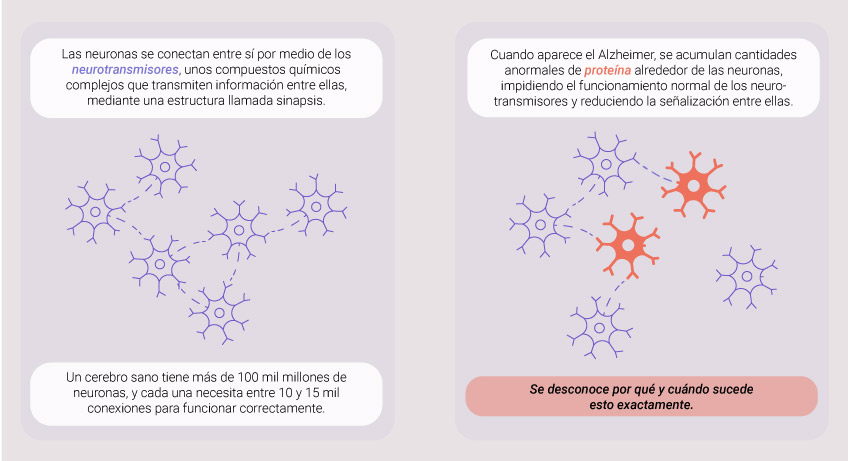 What Causes Alzheimer What Causes Alzheimer