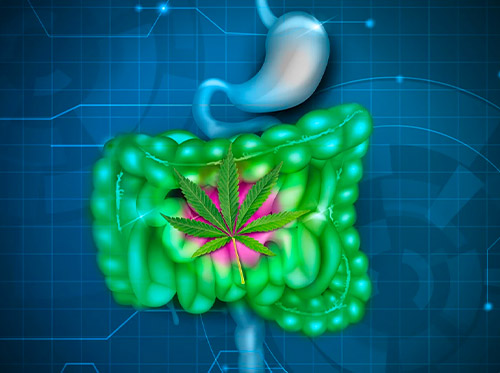 irritable bowel collistis irritable bowel collistis