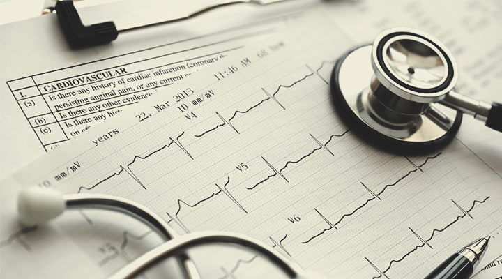 CBD y salud cardiovascular