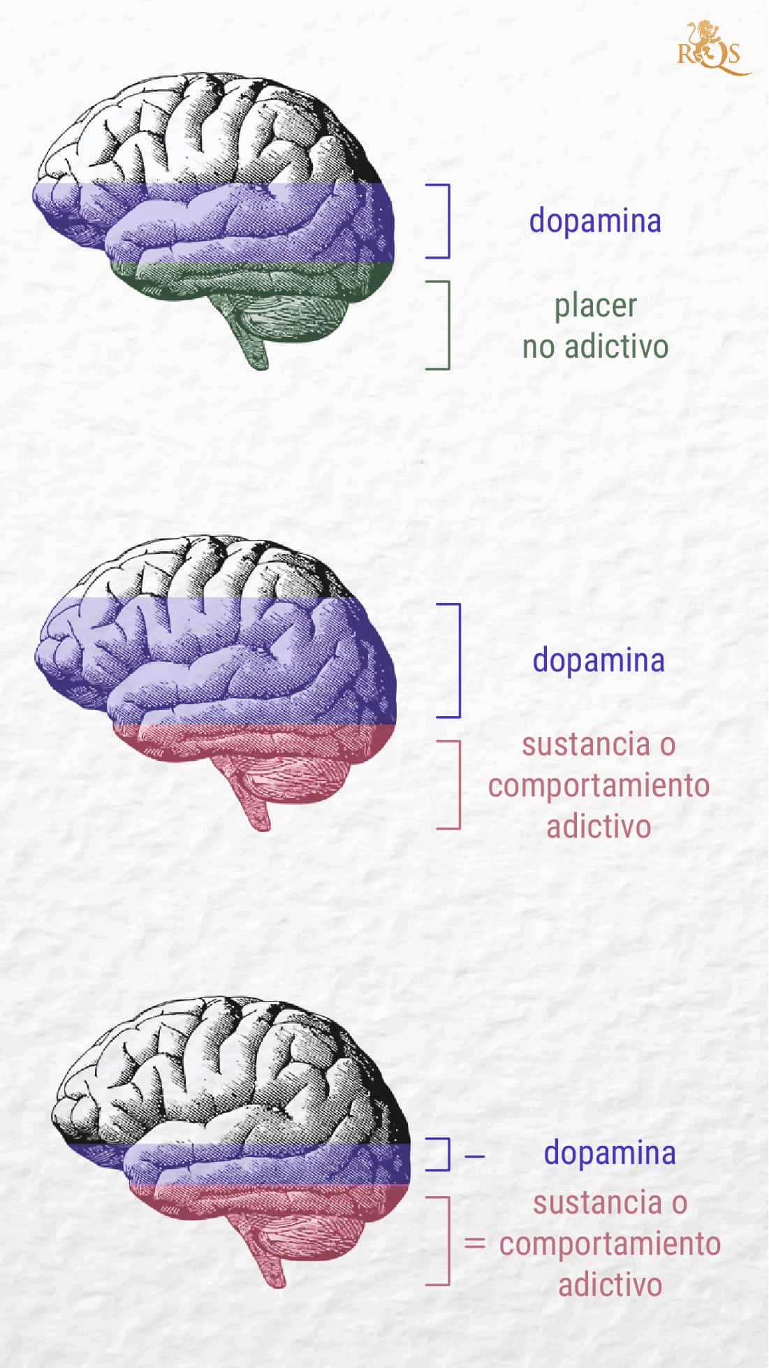 ¿Qué es la adicción? ¿Qué es la adicción?