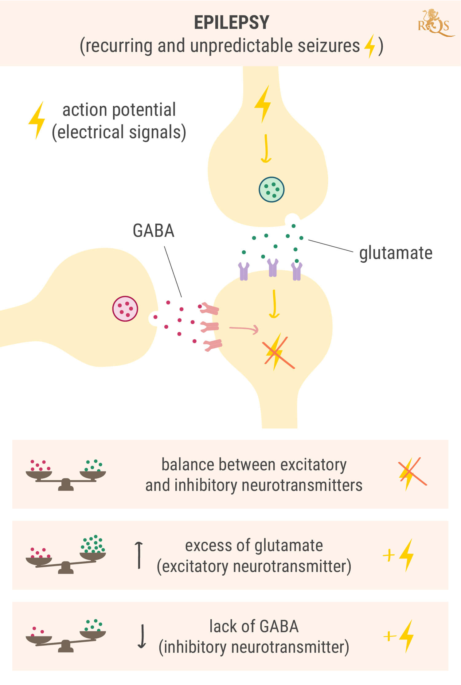 ¿Por qué sucede la epilepsia?