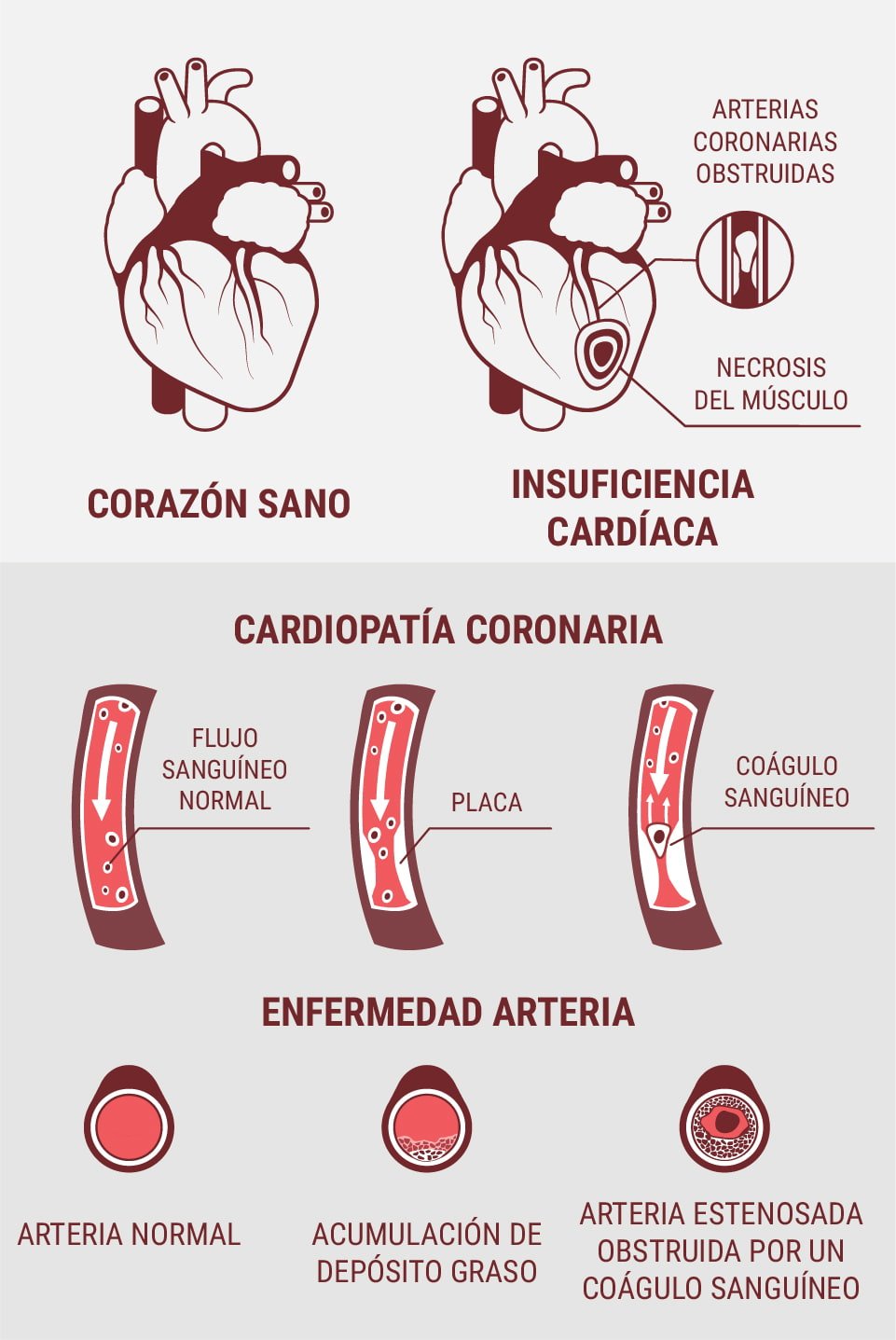 ¿Son lo mismo las enfermedades cardiovasculares y las enfermedades cardíacas?