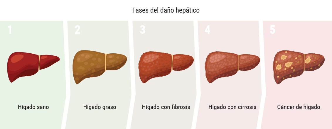 ¿Afecta la marihuana al hígado?