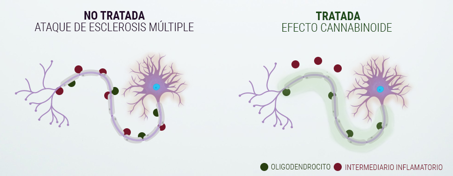 CONSUMIR CANNABIS FRENTE A LA ESCLEROSIS MÚLTIPLE CONSUMIR CANNABIS FRENTE A LA ESCLEROSIS MÚLTIPLE