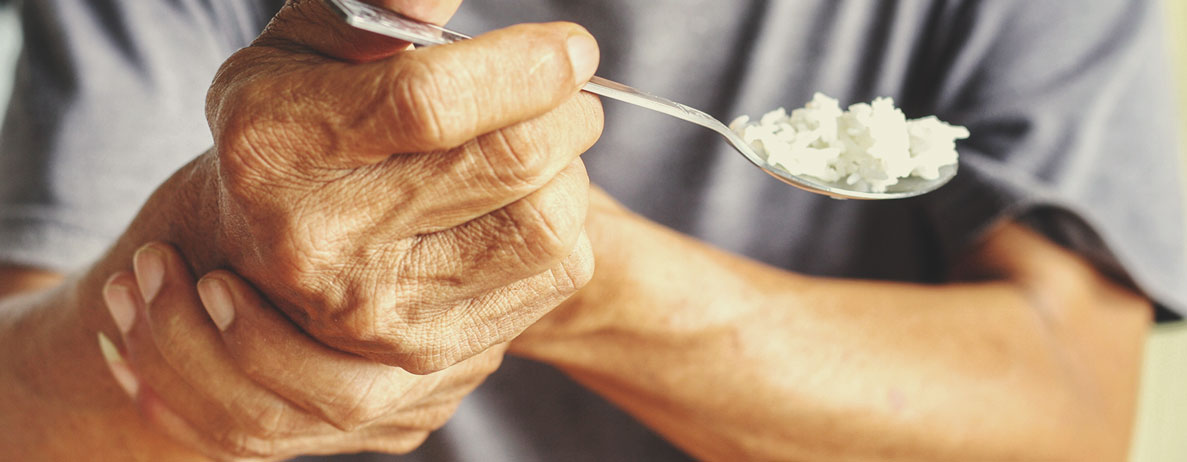 Cómo afecta el Parkinson al cuerpo Cómo afecta el Parkinson al cuerpo