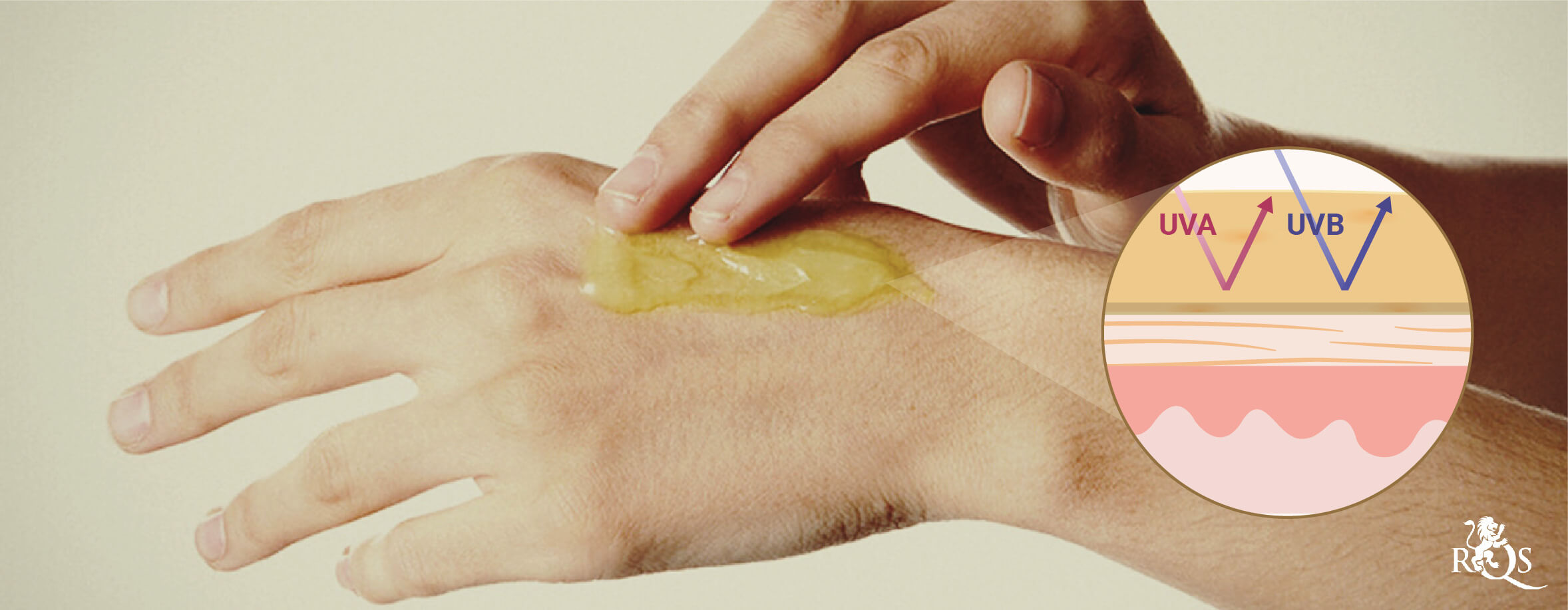 ¿Pueden las lociones de CBD ayudar con las quemaduras solares? ¿Pueden las lociones de CBD ayudar con las quemaduras solares?