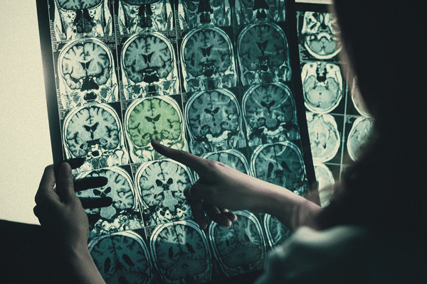 ¿Es efectivo el cannabis para personas con discapacidades?