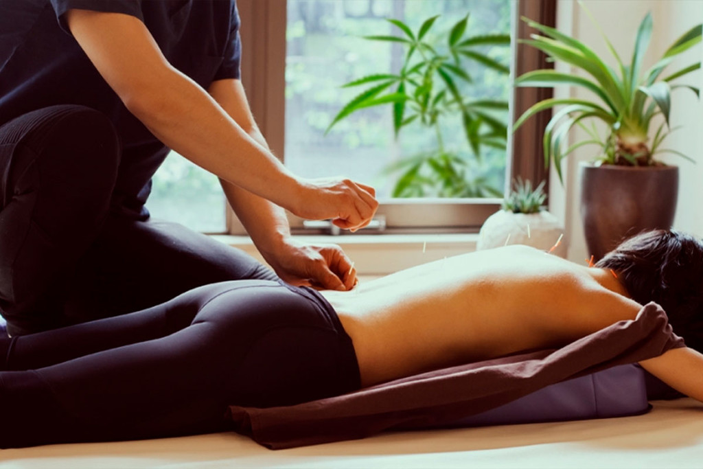 Cannabis y acupuntura: efecto doble para el sistema endocannabinoide